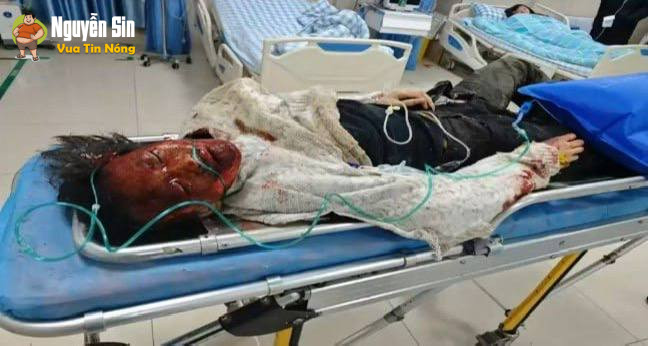 Trung Quốc : Bé gái ném pháo vào cống bị hất tung lên gần 10m