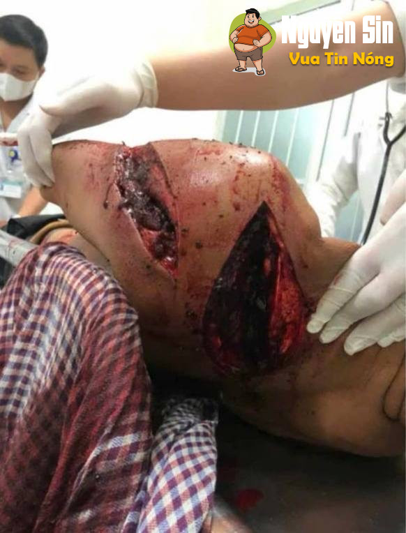 Hậu Giang: Nghe bảo  mâu thuẫn đất đai  1 ng bị 🔪 thấy ớn. Cân nhắc khi xem.