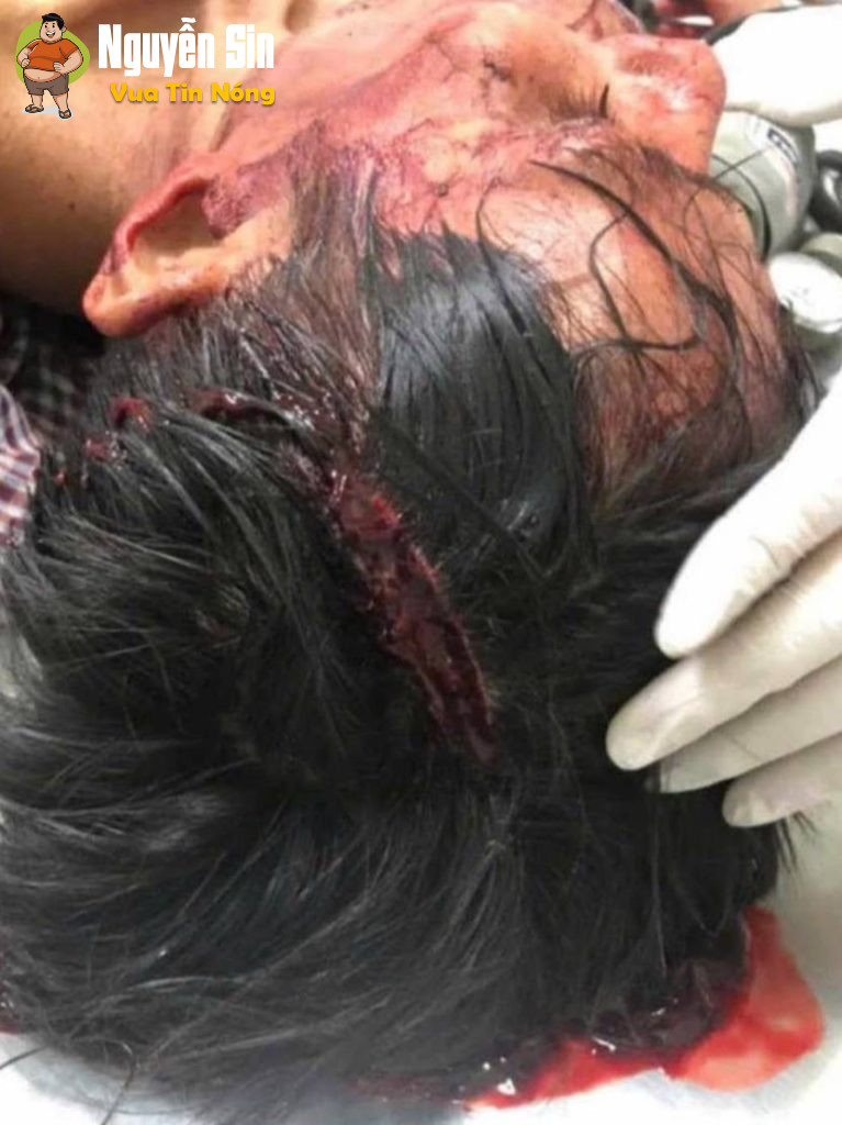 Hậu Giang: Nghe bảo  mâu thuẫn đất đai  1 ng bị 🔪 thấy ớn. Cân nhắc khi xem.