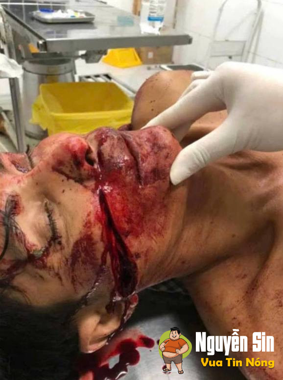 Hậu Giang: Nghe bảo  mâu thuẫn đất đai  1 ng bị 🔪 thấy ớn. Cân nhắc khi xem.