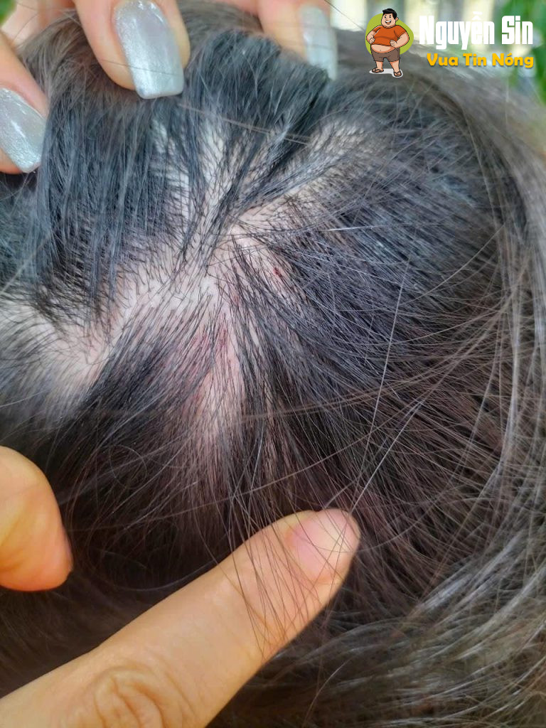 Bắc Giang: Chồng ngoại tình bị vợ phát hiện nên đe doạ giết vợ, mẹ vợ đến đón đưa con gái đi nhưng bị bố chồng đánh nhập viện.