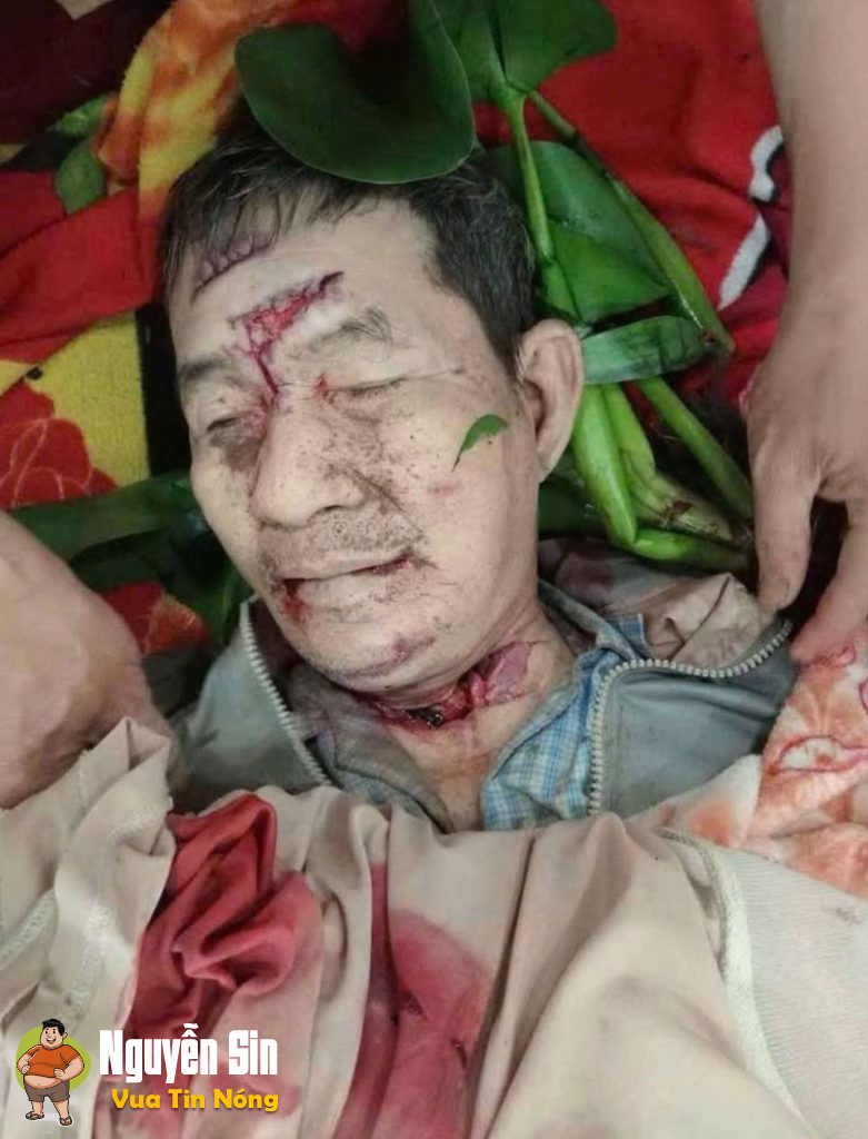 Chợ mới- An Giang: Nghe đồn là dùng dao cắt cổ, cướp vàng vào lúc 4h sáng nay