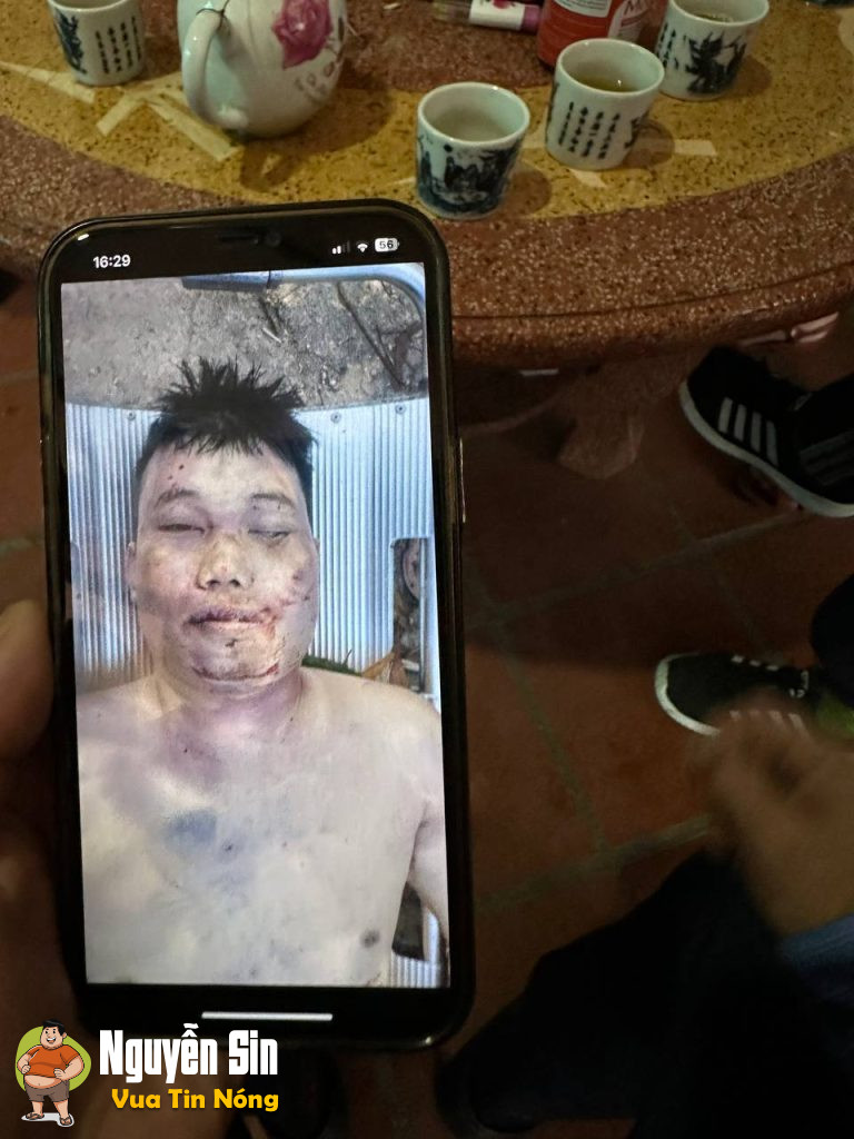 Phát hiện thi thể nam thanh niên đi xe biển Đăk Lăk tử vong ở Bavet,Campuchia. Khu này ngay gần cửa khẩu Mộc Bài. Hiện công an bênCam đang kiếm người thân