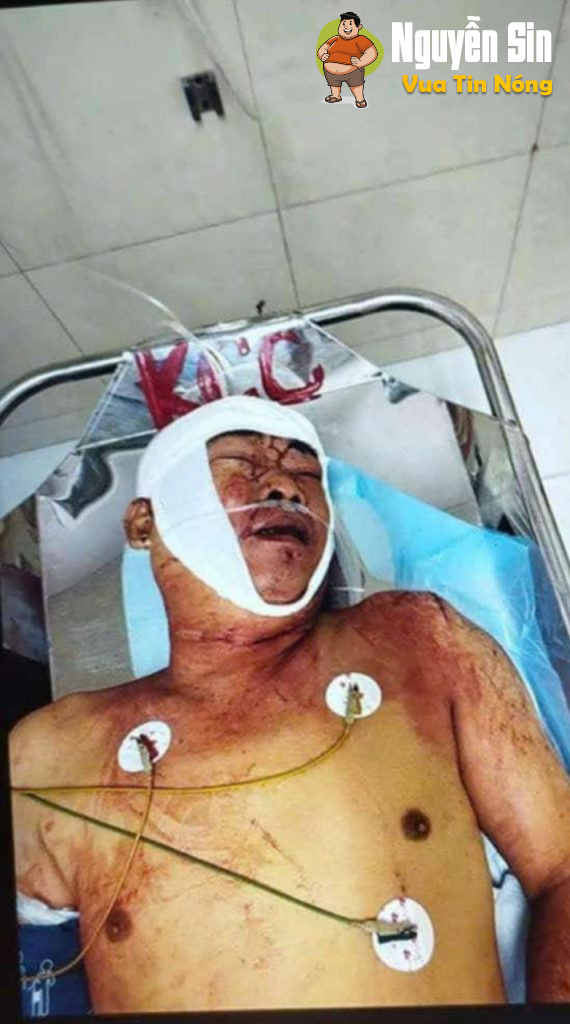 An Giang: Nhân viên soát vé bị ch trọng thương sau khi hỏi khách vé qua phà