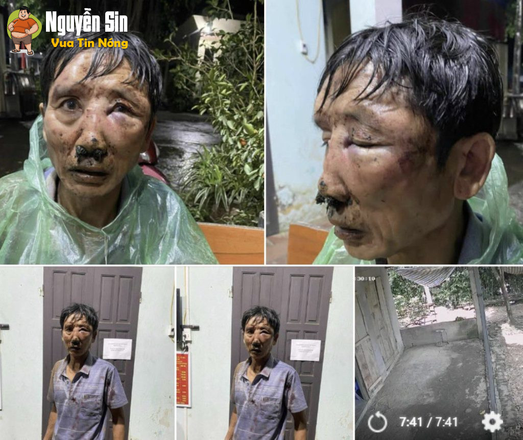 Vụ việc đang xôn xao trên tiktok