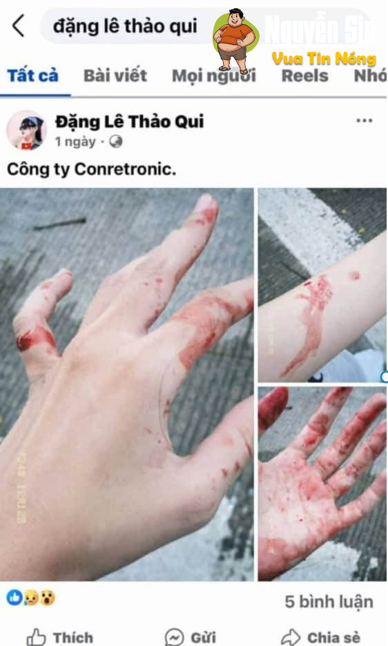 1 bạn nữ bị đ@nh hội đồng ở KCN phú Mỹ 3, Bà Rịa Vũng Tàu