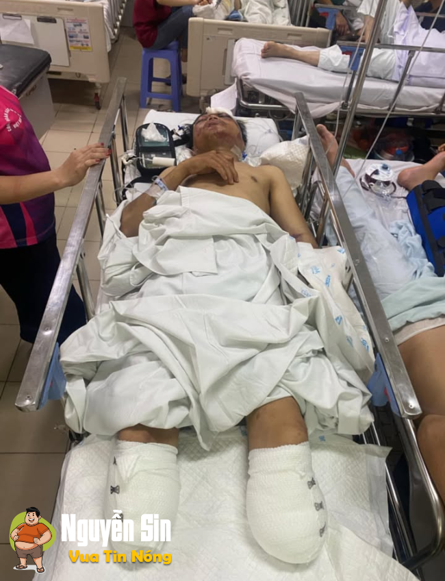Thanh Hóa: TNGT nghiêm trọng khiến 1 người đàn ông bị cán n@t’ 2 chân