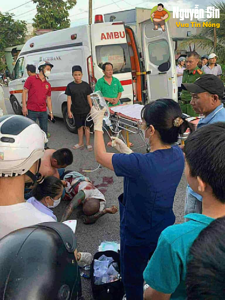 Gia Lai: 1 thanh njen bị 🔪 tv