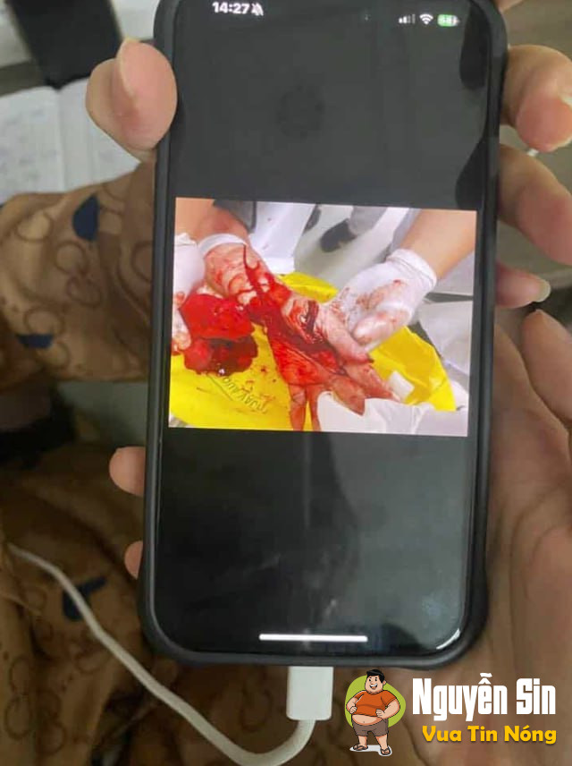 ck che’m vk đô’t nha ở Cà