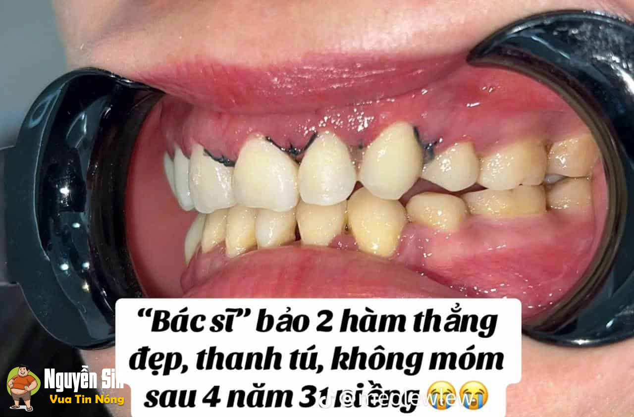 Vụ việc đang xôn xao dư luận tại 1 nha khoa tại TP.HCM