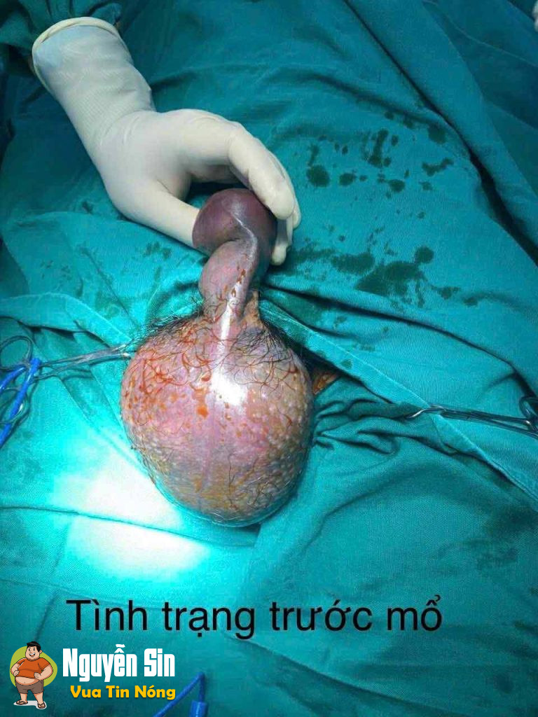 Thái Nguyên : ng đan ôq phải ca’t bỏ tinh ho:àn, sau khj vacham khj đá bóng