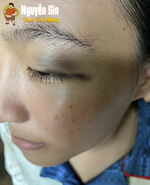 Kiên Giang. 1 €m hs bj đ@’nh h0i đồ/ng đê’n nhâp. vi€n.