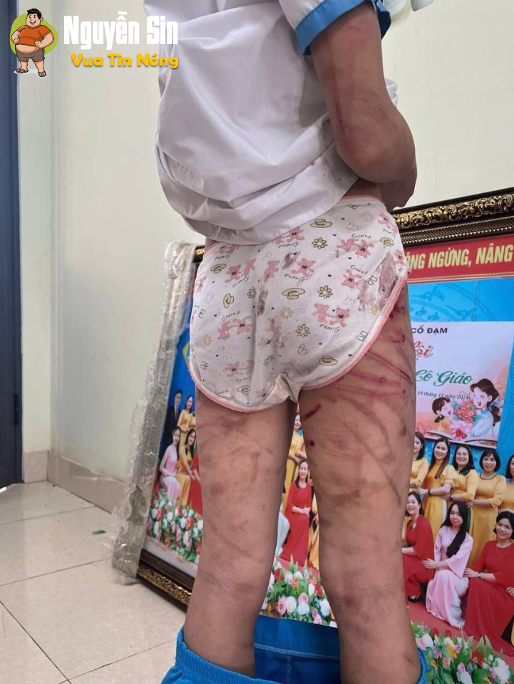 Bé gái lớp 5 ở Hà Tĩnh nghi bị baohanh, cơ thể ch.ằng ch.ịt vết thương Bé gái lớp 5 ở Hà Tĩnh nghi bị baohanh, cơ thể ch.ằng ch.ịt vết thương
