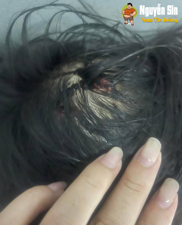Bé gái lớp 5 ở Hà Tĩnh nghi bị baohanh, cơ thể ch.ằng ch.ịt vết thương Bé gái lớp 5 ở Hà Tĩnh nghi bị baohanh, cơ thể ch.ằng ch.ịt vết thương