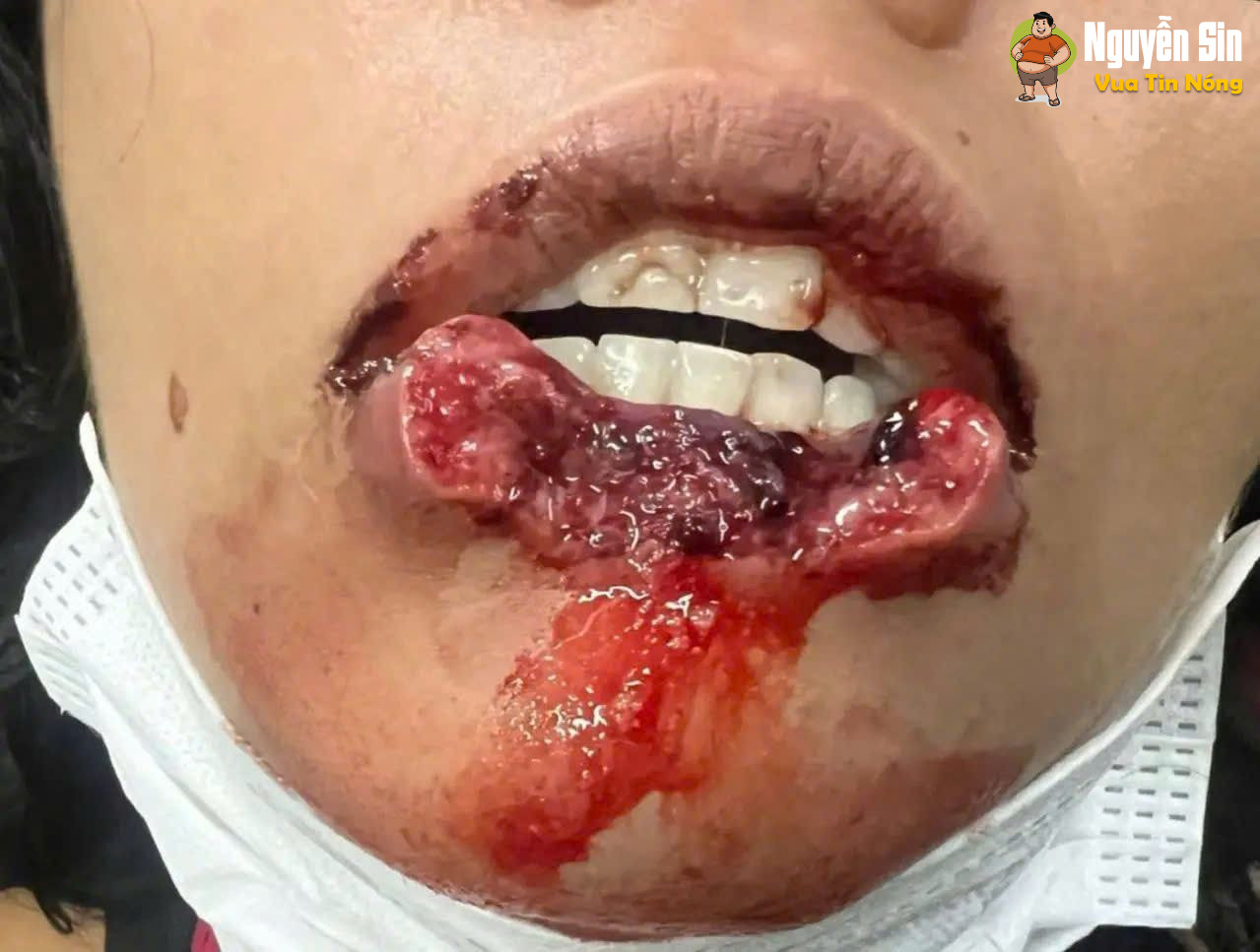 Brazil. yeu nhau qua’ că’n nhau
