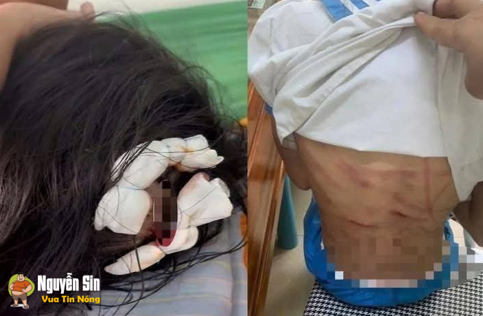 Bé gái lớp 5 ở Hà Tĩnh nghi bị baohanh, cơ thể ch.ằng ch.ịt vết thương Bé gái lớp 5 ở Hà Tĩnh nghi bị baohanh, cơ thể ch.ằng ch.ịt vết thương