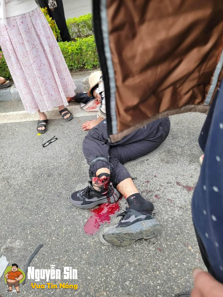 TNGT nghiêm trọng ở Ngã 3 vòng xuyến TP Điện Biên Phủ: khiến 1 người suýt đ/u’t lìa chân TNGT nghiêm trọng ở Ngã 3 vòng xuyến TP Điện Biên Phủ: khiến 1 người suýt đ/u’t lìa chân