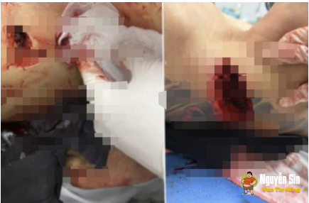 Mâu thuẫn từ 2 triệu đồng, một thanh niên bị ch3’m tv Mâu thuẫn từ 2 triệu đồng, một thanh niên bị ch3’m tv